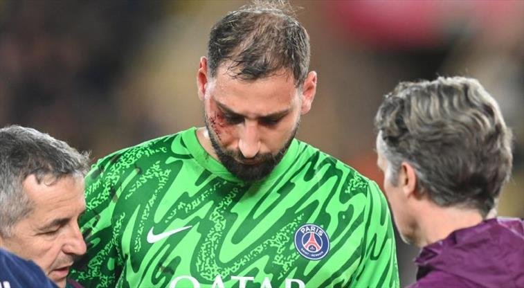 PSG’de şanssız sakatlık! Resmi açıklama geldi…